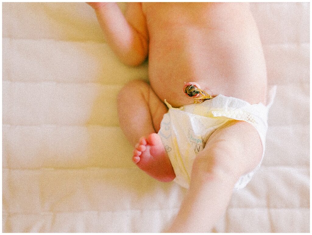 a newborn baby's umbilical cord